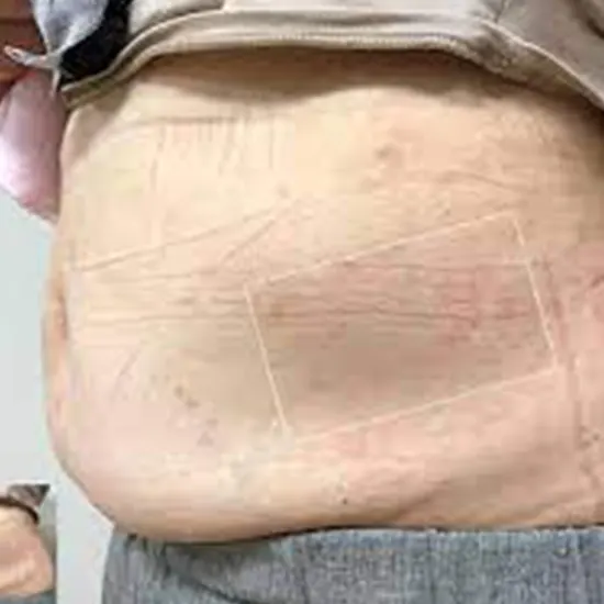 abdominal swelling package test